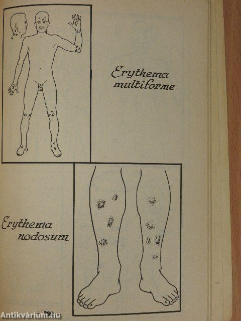 Bőrgyógyászati jegyzet