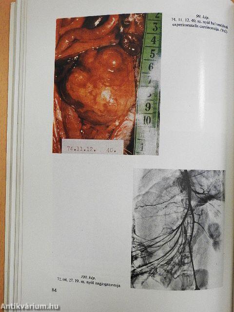 Farmakoangiográfia a daganatok kórismézésében