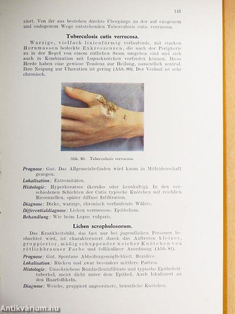 Kurzgefaßtes Lehrbuch der Haut- und Geschlechts-Krankheiten