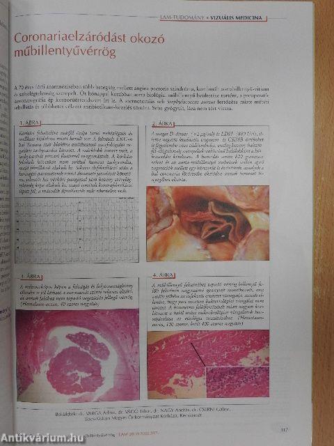 Lege Artis Medicinae 2010. május