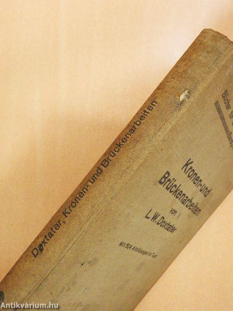 Kronen- und Brückenarbeiten