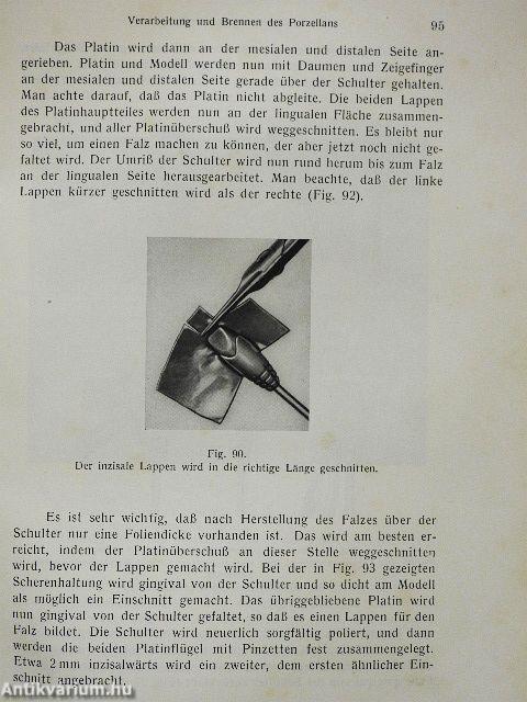 Kronen- und Brückenarbeiten