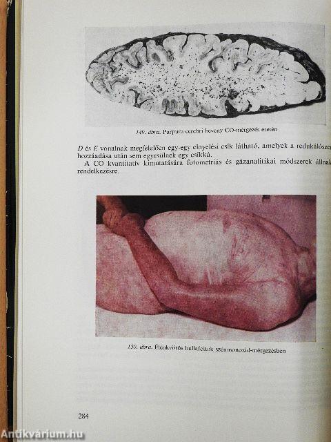 Az igazságügyi orvostan alapjai