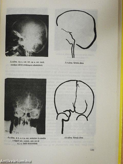 Klinikai pszichológia