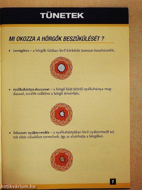 Amit az asztmáról tudni kell...