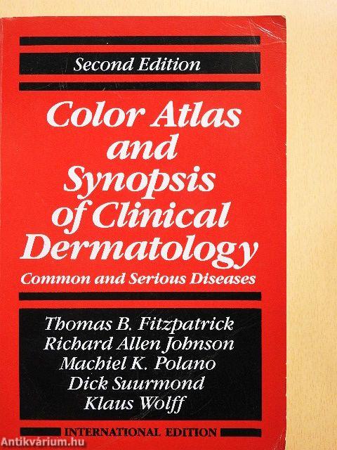 Color Atlas and Synopsis of Clinical Dermatology
