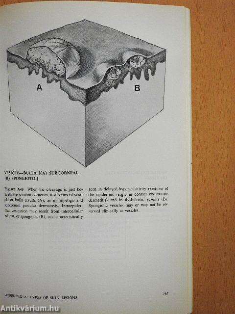 Color Atlas and Synopsis of Clinical Dermatology
