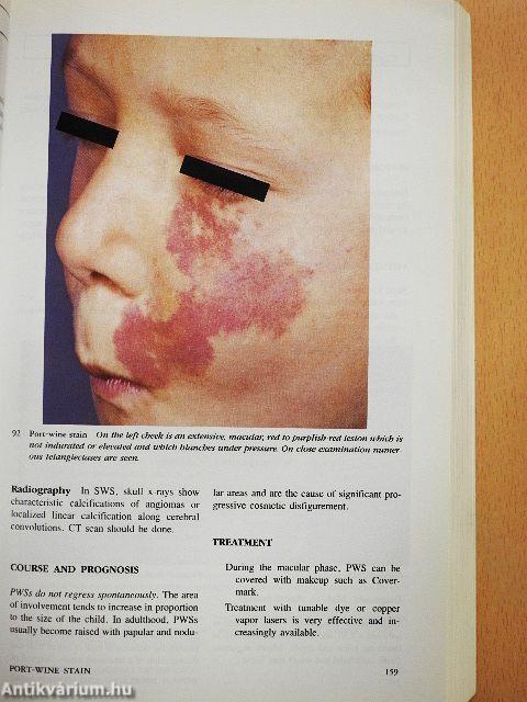Color Atlas and Synopsis of Clinical Dermatology