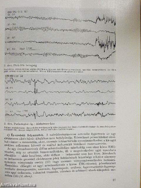 Öregkori ideg- és elmegyógyászati kórképek