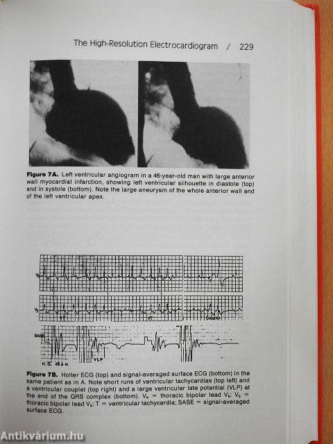 High-Resolution Electrocardiography