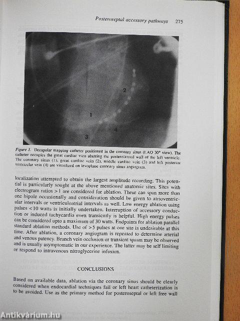 Practice and Progress in Cardiac Pacing and Electrophysiology