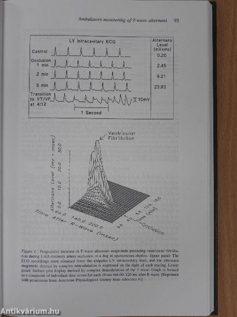 Practice and Progress in Cardiac Pacing and Electrophysiology