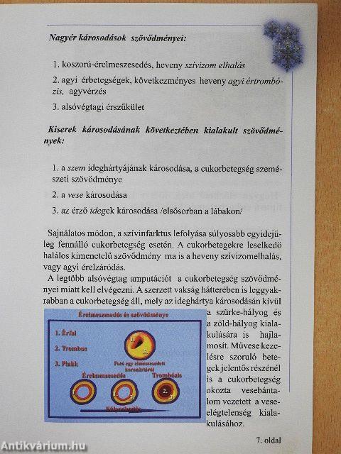 Cukorbeteg lettem...