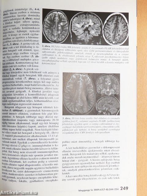 Ideggyógyászati Szemle 2009. július 30.