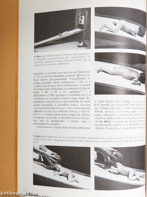 Ideggyógyászati Szemle 2001. május 20.