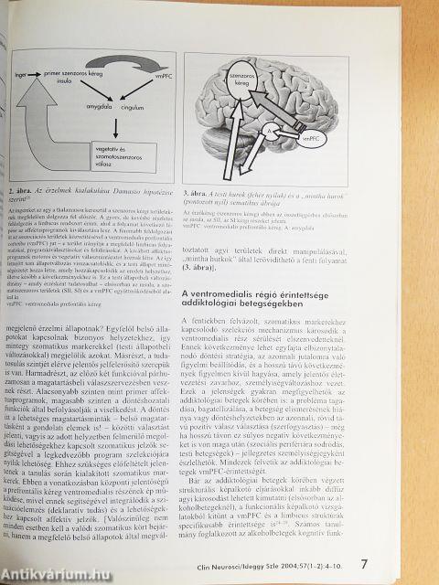 Ideggyógyászati Szemle 2004. január 20.