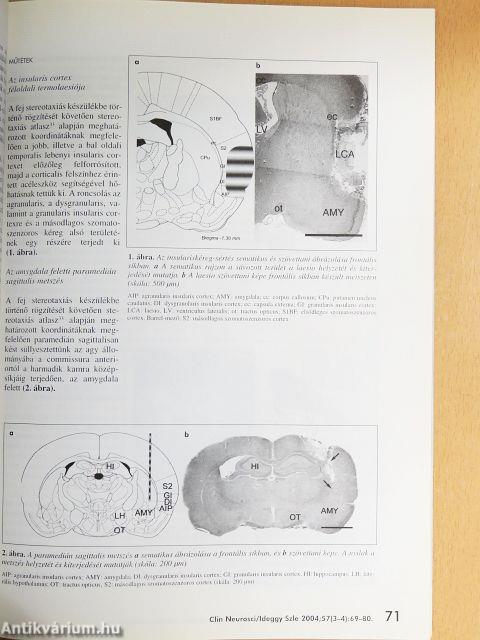 Ideggyógyászati Szemle 2004. március 20.