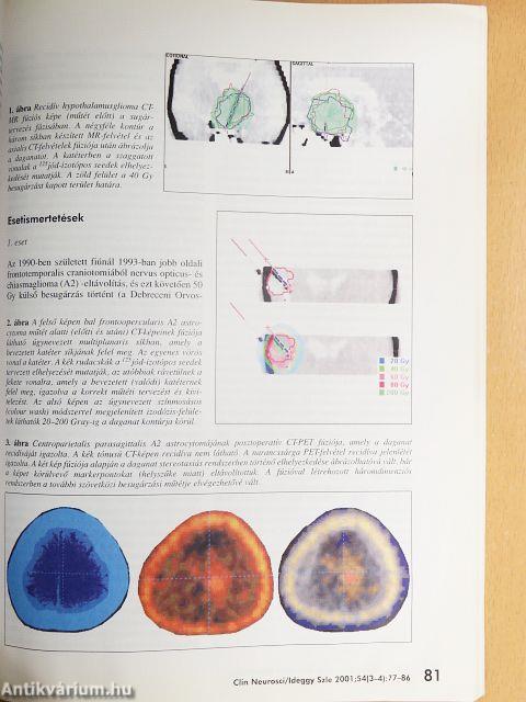 Ideggyógyászati Szemle 2001. március 20.