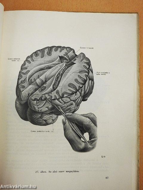 Az agyvelő boncolása