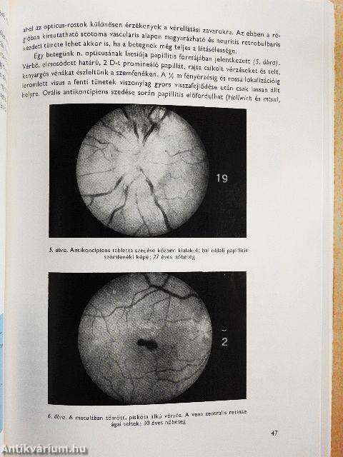 Orális kontraceptivumok és érbántalmak