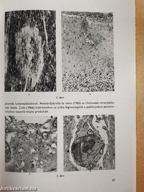 Orális kontraceptivumok és érbántalmak