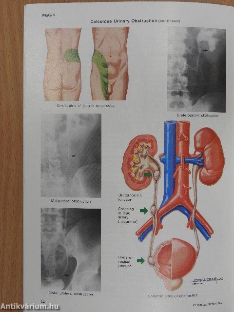 Clinical Symposia 3/1986