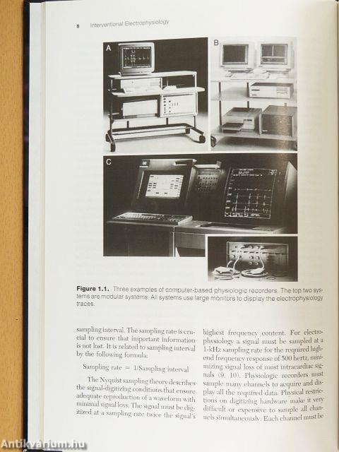 Interventional Electrophysiology