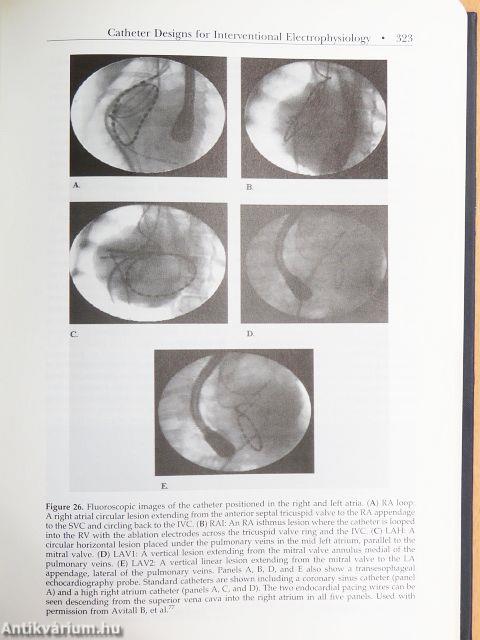 Nonpharmacological Therapy of Arrhythmias for the 21st Century