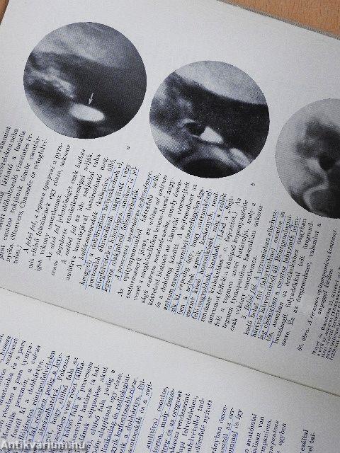 Orr-, fül-, gégészeti röntgendiagnosztika 
