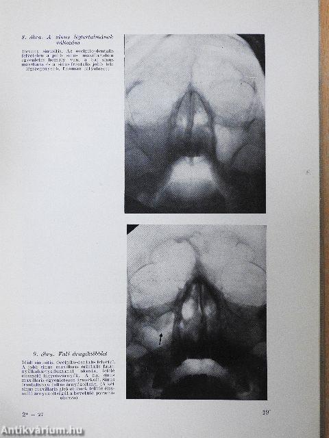 Orr-, fül-, gégészeti röntgendiagnosztika 