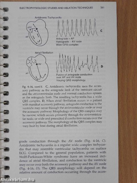 The Cardiac Catheterization Handbook