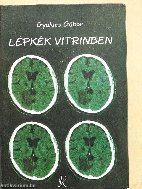 Lepkék vitrinben