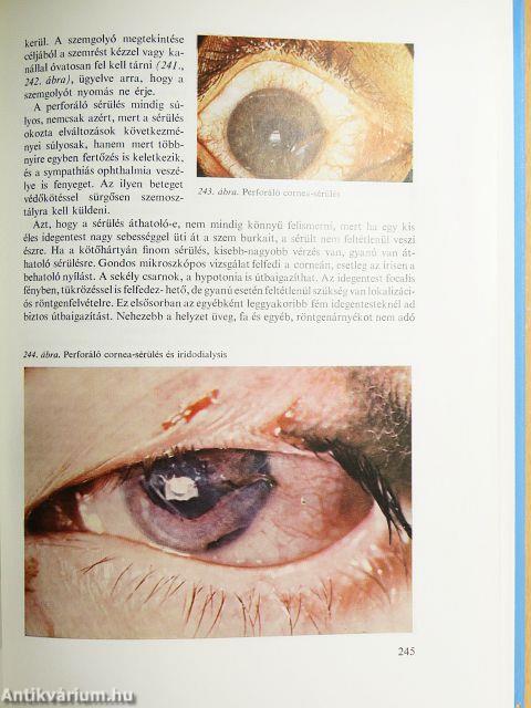 A szemészet alapvonalai 