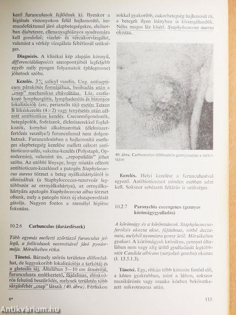 Bőr- és nemi betegségek