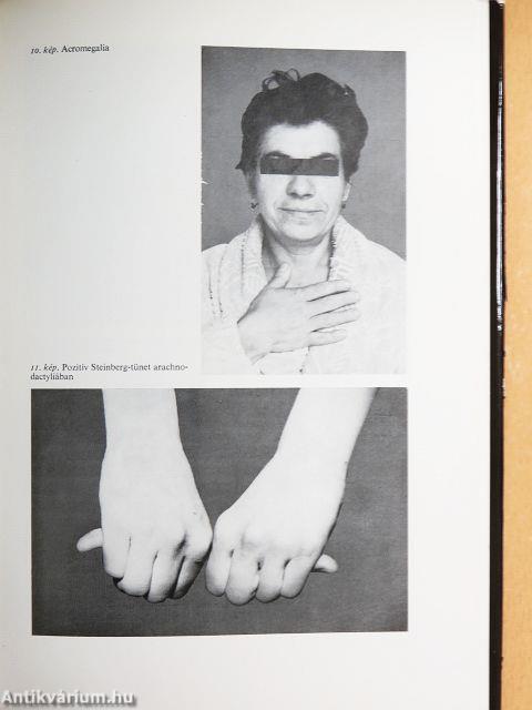 Klinikai endocrinologia 1-2.