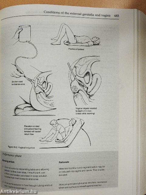 The Lippincott manual of Medical-Surgical Nursing