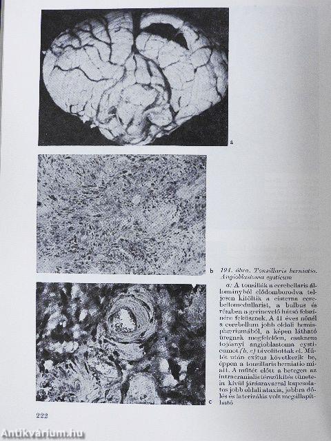 A klinikai neurológia alapjai