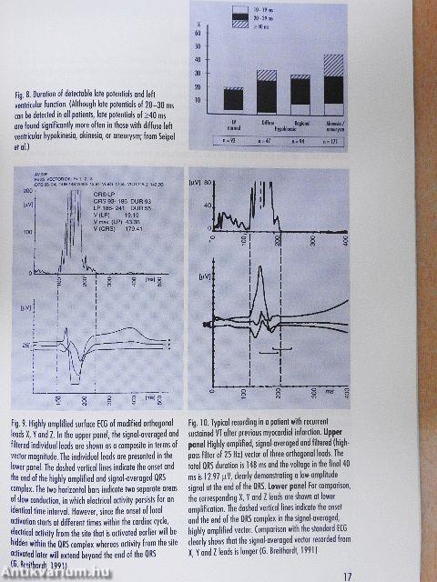 Diagnosis and Treatment of Cardiac Arrhythmias: New Trends