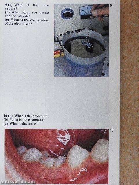 Diagnostic Picture Tests in Dentistry