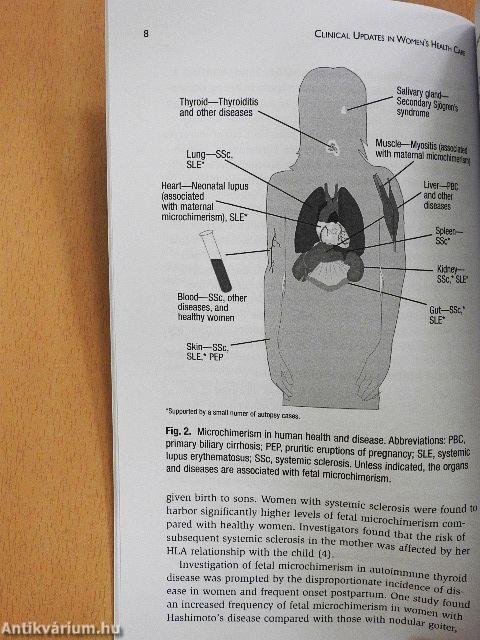 Autoimmune Disorders