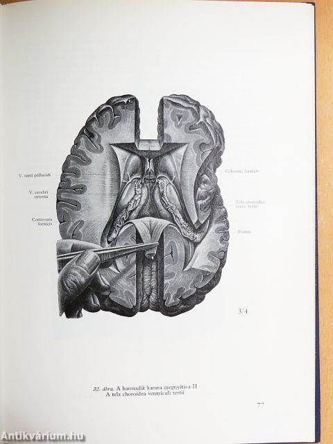 Az agyvelő boncolása