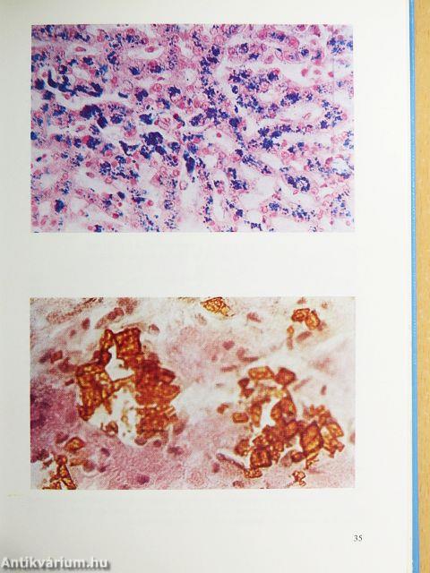 Kórszövettani gyakorlatok