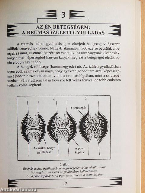 Reumás és ízületi fájdalmaink gyógyítása