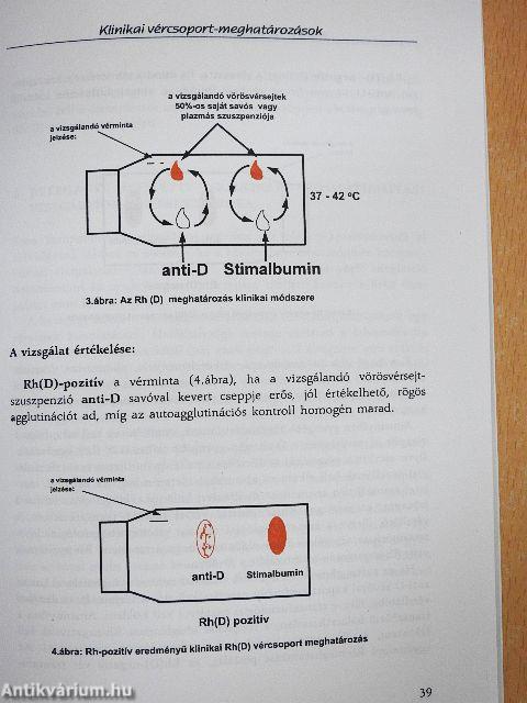 Transzfúziós szabályzat