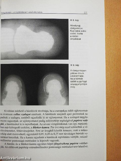 Árulkodó ujjnyomok