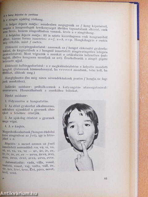 A gyakori beszédhibák