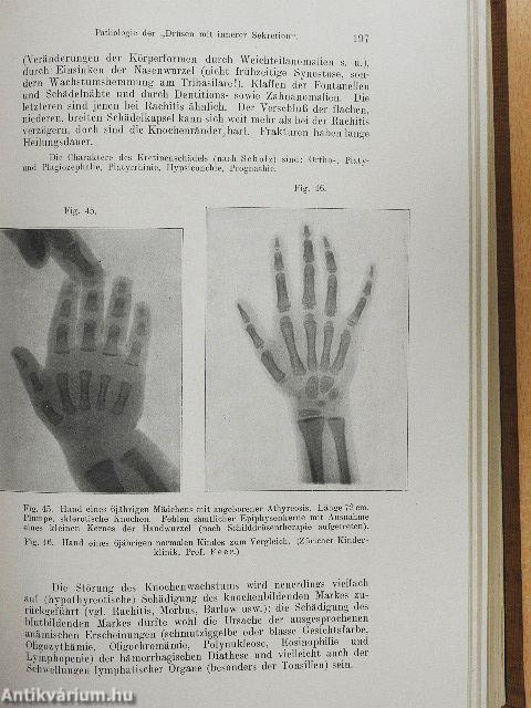 Lehrbuch der Kinderheilkunde