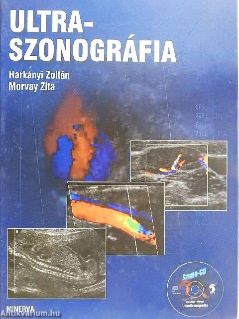 Ultraszonográfia - CD-vel