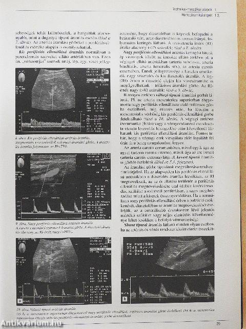 Ultraszonográfia - CD-vel