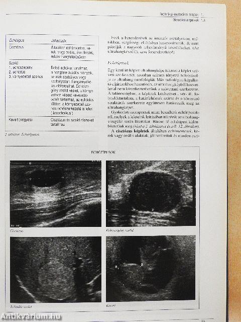 Ultraszonográfia - CD-vel